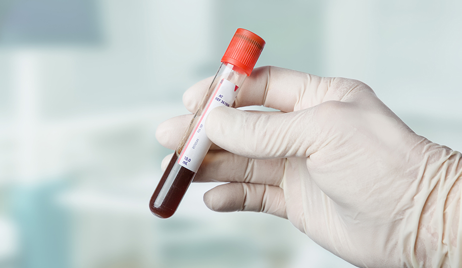 blood cancer سرطان خون